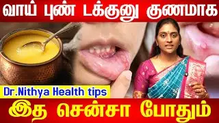 Mouth Ulcer Treatment at Home - Vaai Pun - Health Tips in Tamil வாய் புண்கள் வராமல் தடுக்கும் வழிகள்