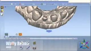Planscan E4D CAD/CAM Case Planmeca FIT