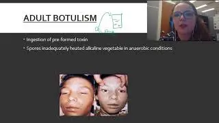 Clostridia botulinum