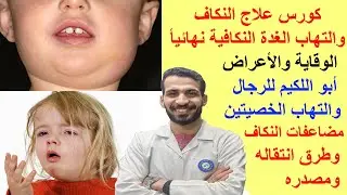كورس علاج النكاف والتهاب الغدة النكافية نهائيأ _الوقاية والأعراض_ أبو اللكيم للرجال والتهاب الخصيتين