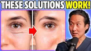 How to Rejuvenate Your Eyes! Get Rid of Dark Circles, Bags, Puffiness, Crow’s Feet, and More…