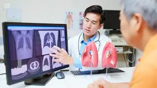Single-cell immune signatures in peripheral blood for diagnosis of pulmonary nodules
