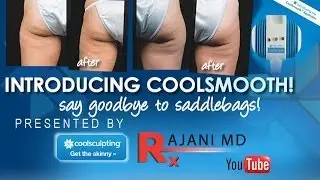 See the NEW Coolsmooth Coolsculpting-Rajani-Oregon
