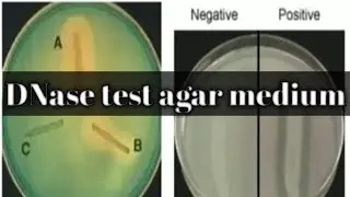 DNase test: biochemical test lecture 15