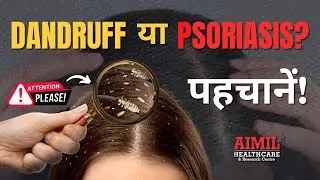 कहीं आप जिसे Dandruff समझ रहे हैं, वो Psoriasis तो नहीं? | पहचानें असली फर्क!