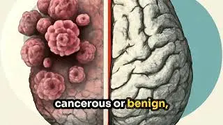 Understanding Acquired Brain Injury Part 2  Causes