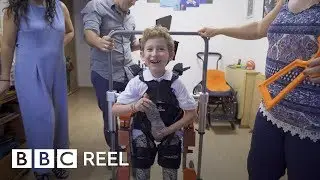 The boy with the robot body - BBC REEL