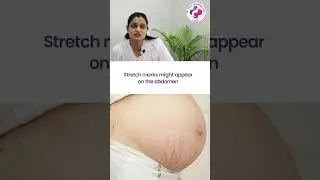 Changes in Mother at 21st Week of Pregnancy - 21वें सप्ताह में माँ के शरीर में होने वाले बदलाव