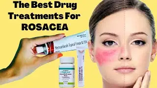 The Best Drug Treatments For ROSACEA | Rosacea Prevention Tips