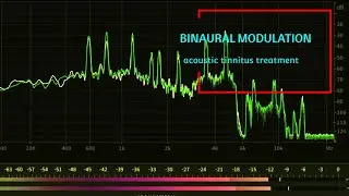 Acoustic Tinnitus Treatment | Binaural Modulation Sounds for Tinnitus Relief