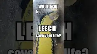 Why Are Leeches Used In Medicine?