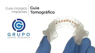 Guia Cir&uacute;rgico / Tomogr&aacute;fico para implantes dentais, como fazer?