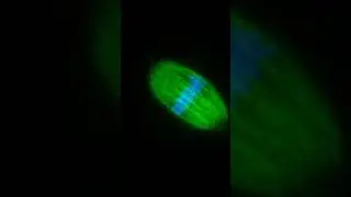 Meiotic Spindle essential structure of oocyte.