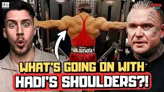Behrouz Gets a Visa, Derek Under Fire & What's Going On With Hadi's Shoulders?!