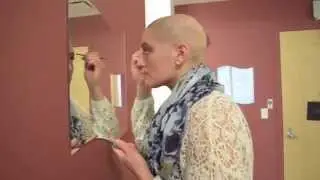 Alexandra Coppola Alopecia Story