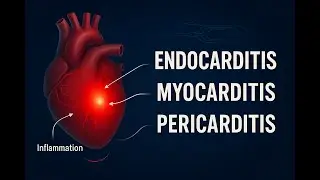 Endocarditis, Myocarditis, Pericarditis NCLEX Review (MUST KNOW Tips). Cardiology pt. 3