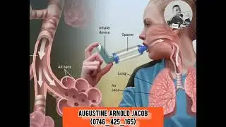 ELIMU YA UGONJWA WA ASTHMA (PUMU).