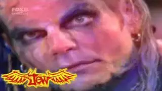 Jeff Hardy - Superman's Dead [Read Descriptions]