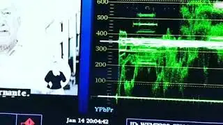 Digital Video Tektronix Equipment