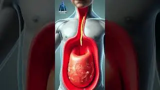 He Ate Ice Cream Daily 🍨❌ Now His Gut Health Is Destroyed