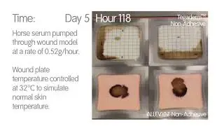 Allevyn   Foam Dressing Comparison   ALLEVYN&loz; Non Adhesive vs TegadermTM Non Adhesive