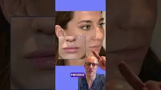 Achieving Perfect Lips: The 8D Lip Design Technique Explained | Safe & Natural Lip Filler