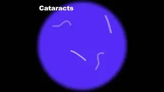 KMAT Macular Acuity Test - How It Works
