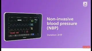 Non-invasive blood pressure monitoring with the IntelliVue monitor