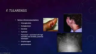 23 - Misc. Gram-Negative Rods
