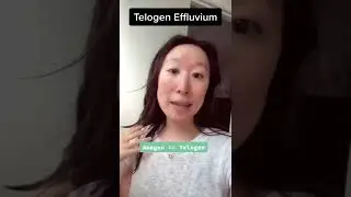 Telogen Effluvium massive #hair shedding but IT WILL GET BETTER! #learnfromme | #shorts #dermatology