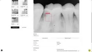 Demo - Dental X-Ray Analysis AI