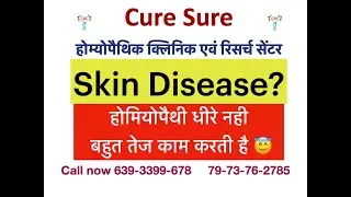 Psoriasis CURED BY Homeopathy