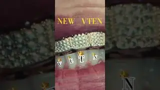 NEW _ VTEN 🔥😱👑: nepali trending rap song #trending #viral ##shorts #funny #viralshorts #viralvide