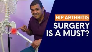 Is Surgery Mandatory for Bone-on-bone Hip Osteoarthritis?