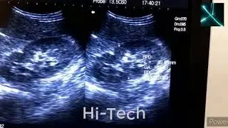 Novadex N50 Laptop Style Ultrasound Machine | Hi-Tech Engineering Ly | #hitechEngineeringLy