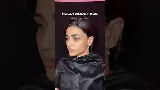 Hollywood face treatment #recommended#рек#top#beauty#aesthetic#lifting#lips#botox#skincare#fullface