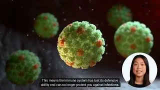 What Is Felty Syndrome?