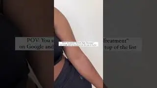 POV: Stretch Mark Treatment #tattoo #pmuartist #pmu #pmutraining
