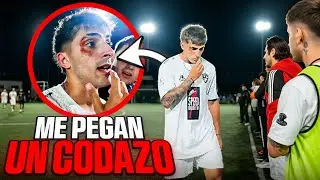 ME PEGAN UN CODAZO EN PLENO PARTIDO
