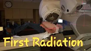 First Radiation Treatment for Stage 4 Throat Cancer. How I Feel After 2 Chemo Treatments