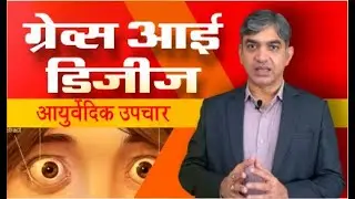 Freedom from Bulging Eyes: Ayurvedic Cure for Graves&rsquo; Eye Disease