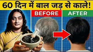सफेद बाल हमेशा के लिए काले? आयुर्वेद का 3-Step 
