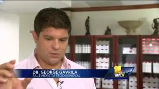 Free tattoo removal for breast cancer survivors