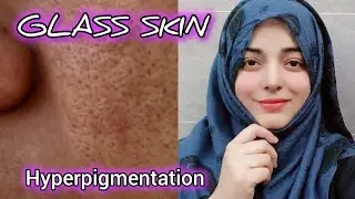 My Beautiful Glass Skin Secret Just Mix These Magical Powder  | Live Results | Skin Whitening Tips 
