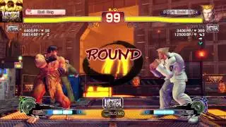 #2 Ryu vs Guile PS4 USF4