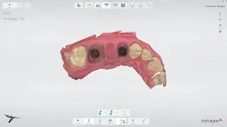 3ShapeTRIOS - Implant Bridge Workflow PL