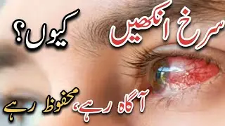 Prevent eye infection | Eye care tips | Eye protection | Eye health awareness | Infection prevention