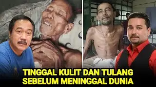 Sangat Miris, Tubuh 8 Artis Ini HanyaTinggal Kulit Dan Tulang Sebelum Meninggal Dunia