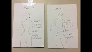 Weight Loss | First 7 Days of Container Concept for Food Intake Control | Body Image