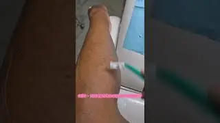 help! #satisfying #hairremoval #skin #hairremoval ##pcos #hairy #hairremovalmethods #legs